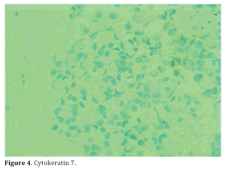 pancreas-Cytokeratin7