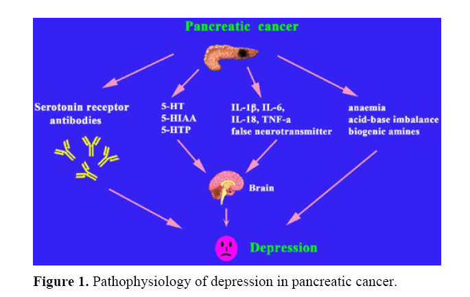 Weight Loss, Diabetes, Fatigue, and Depression Preceding Pancreatic Cancer.