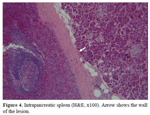 pancreas-intrapancreatic-spleen-arrow